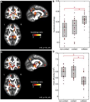 Structural, Functional, and Metabolic Brain Markers Differentiate Collision versus Contact and Non-Contact Athletes
